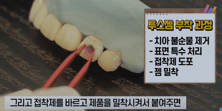 투쓰젬-부착-과정