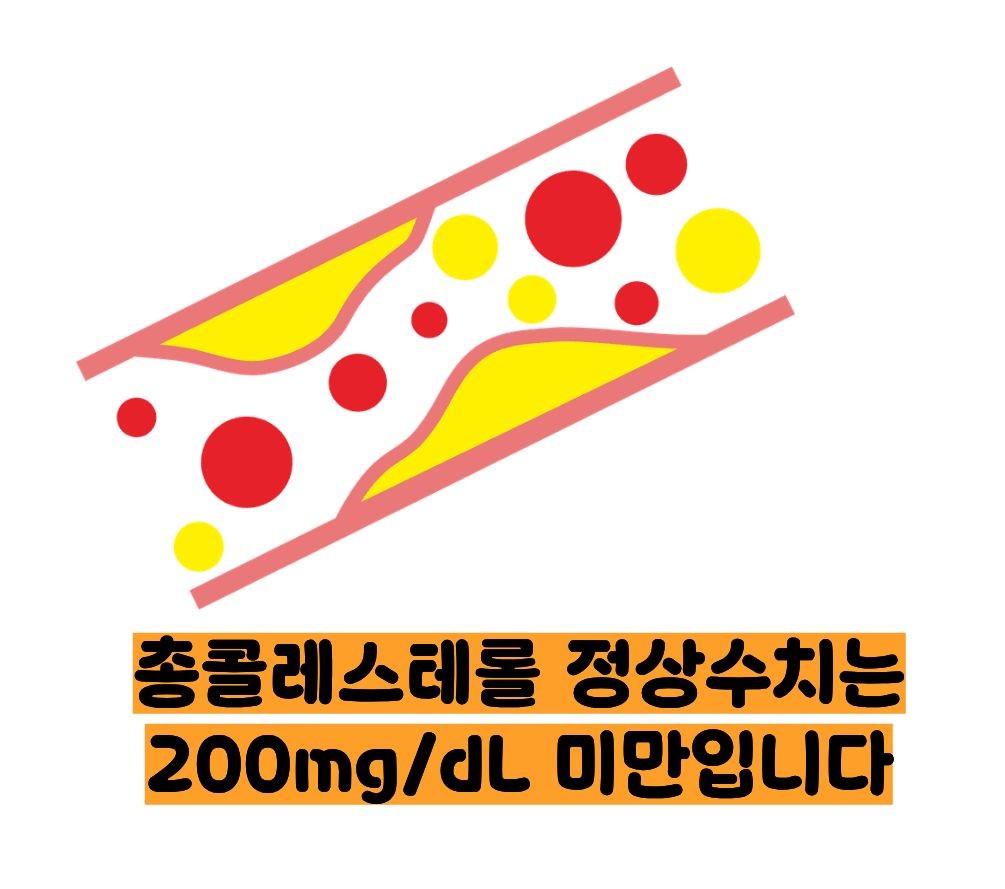 총콜레스테롤 정상수치