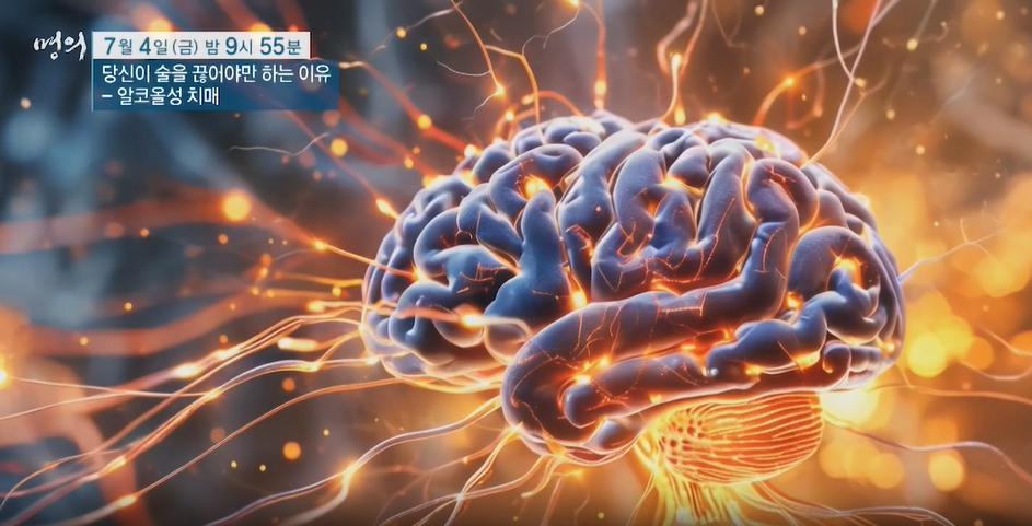 명의 알코올성 치매