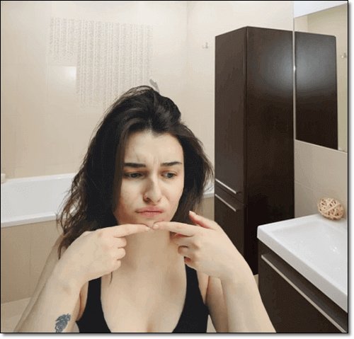 피부염이 심한 여성