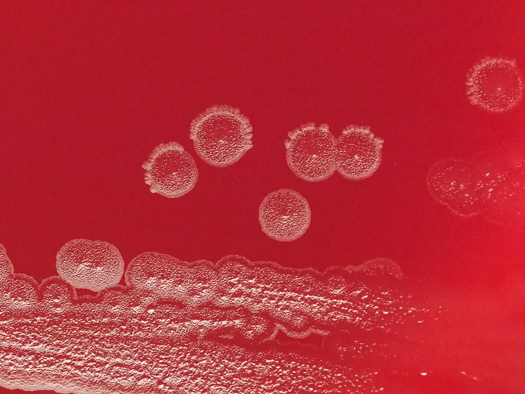 NK cell therapy