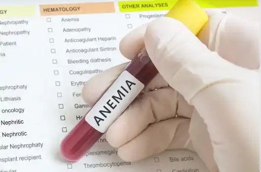 부정맥 원인 및 증상&amp;#44; 치료방법