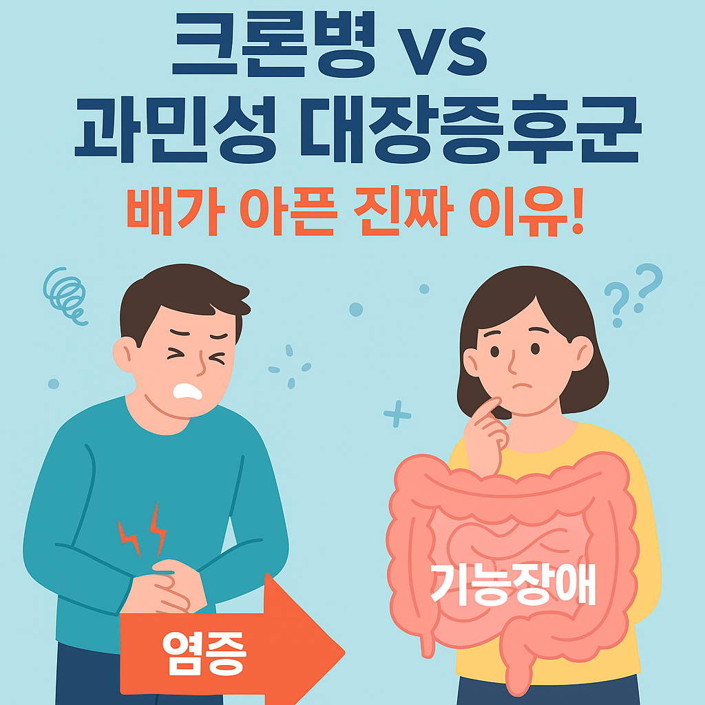 크론병 vs 과민성 대장증후군 배가 아픈 진짜 이유는?