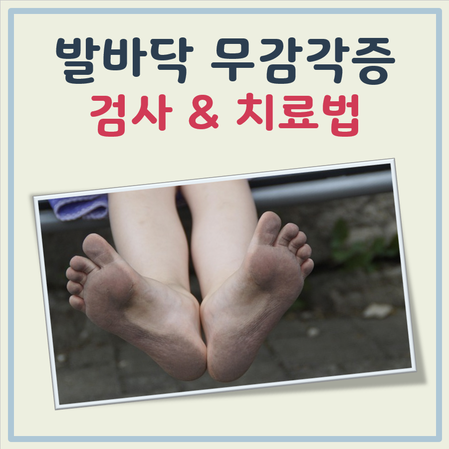 발바닥 무감각증치료법 대표 이미지
