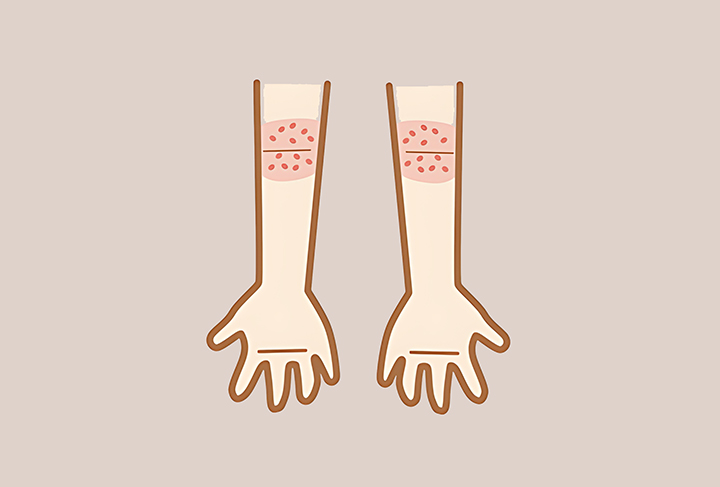 건조해서-갈라진-피부