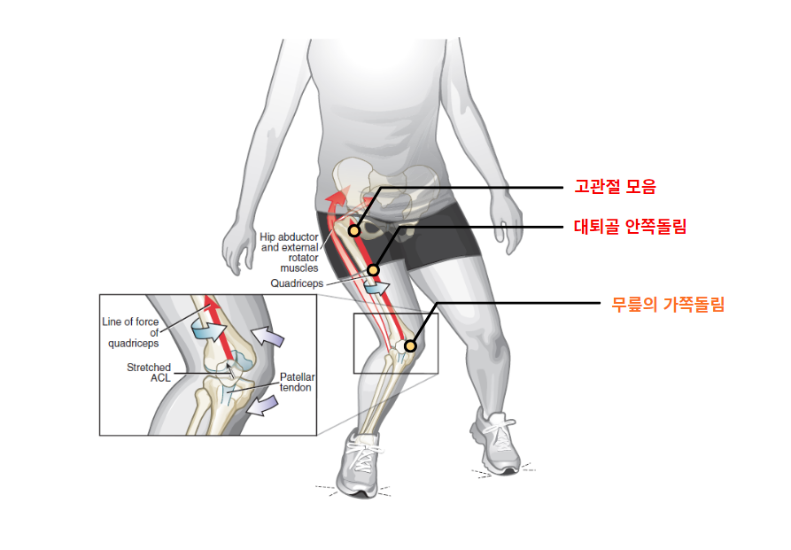 ACL 손상 기전