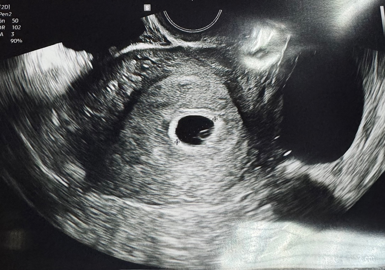 뽀물이 난항사진