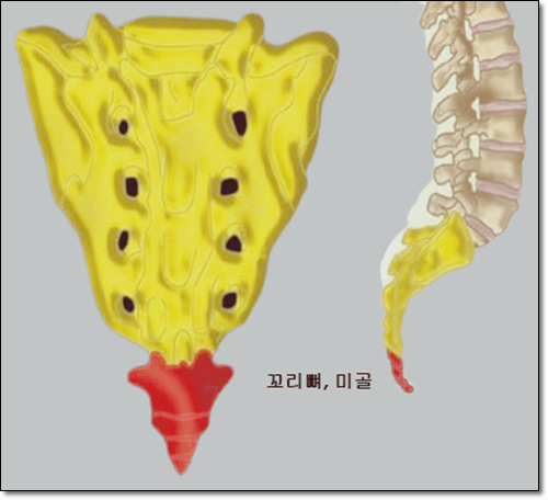미골통 꼬리뼈 통증