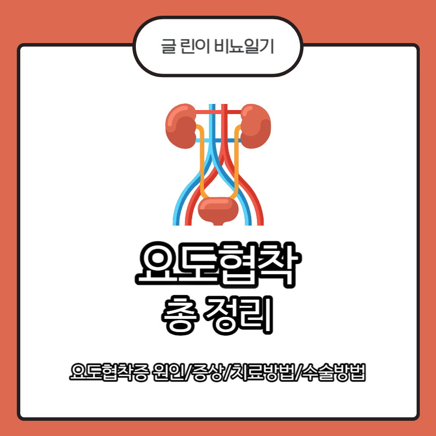 요도협착
요도협착증
요도협착 원인
요도협착 증상
요도협착 치료방법
요도협착 수술방법