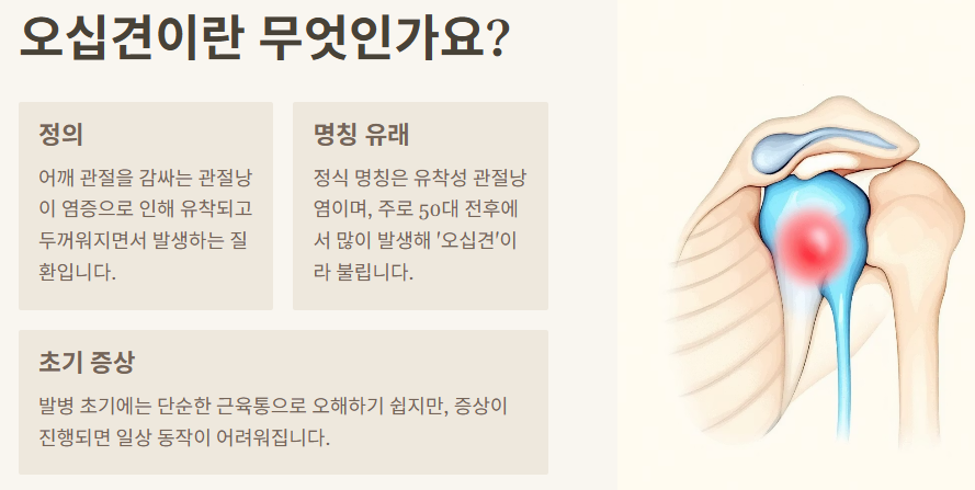 오십견이란 무엇인가? 이미지