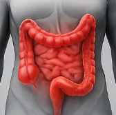 대장암 초기증상