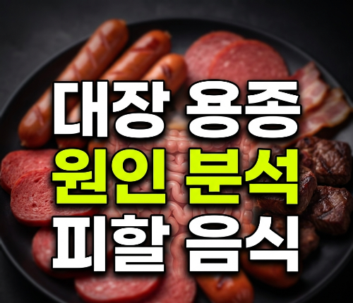 대장 용종 원인과 피해야 할 음식 정리(+증상,원인,제거 후 식사)