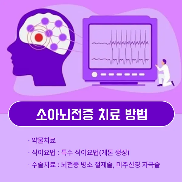 소아뇌전증 치료