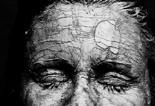 피부암 초기증상 11