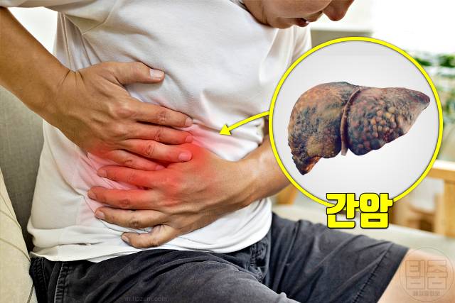 간암 증상 생로병사의비밀 오른쪽 갈비뼈 아래 통증