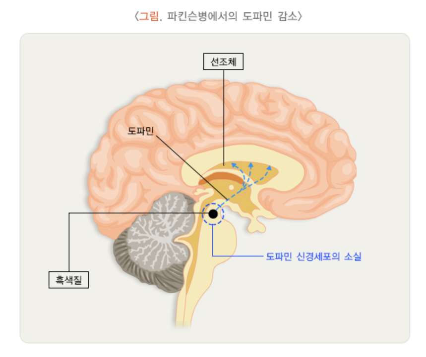 도파민 감소