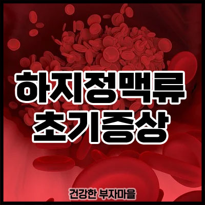 하지정맥류 초기증상