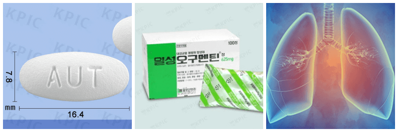 오구멘틴정, 기관지염 사진