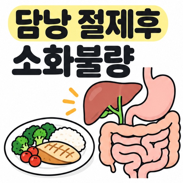 담낭 절제 후 소화불량 제목과 위장, 식사 접시를 차분하게 표현한 건강 정보 카드