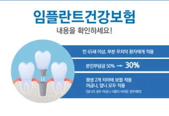 임플란트 지원 대상 건강보험 적용 연령 비용 안내_30