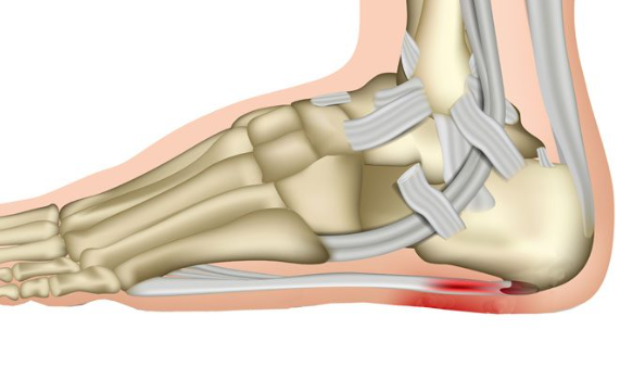 발등이 찌릿찌릿 증상