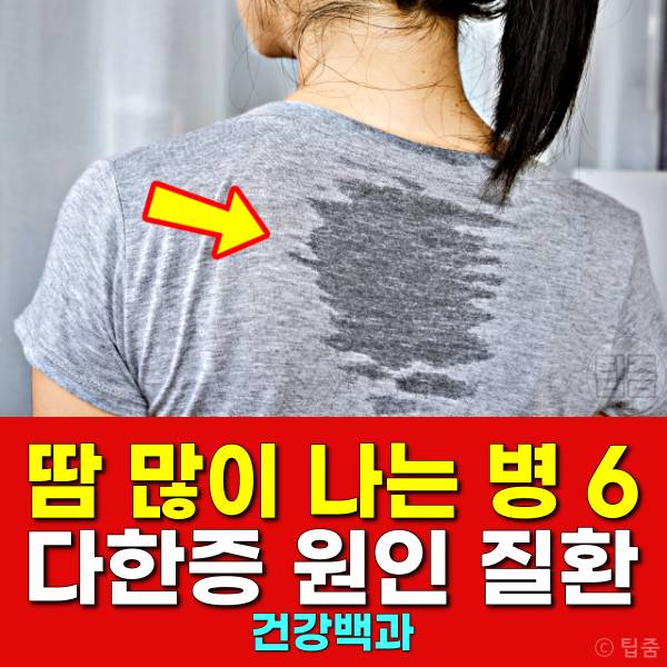땀 많이 나는 병 다한증 원인
