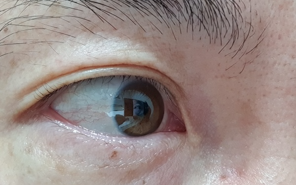 가까운-거리에서-촬영한-눈