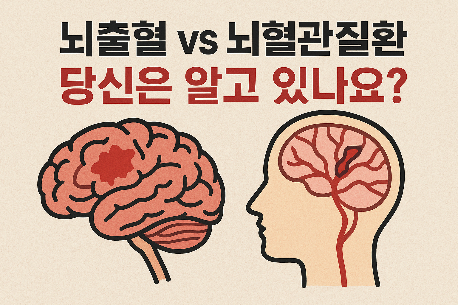 뇌출혈 vs 뇌혈관질환, 같은 병일까?