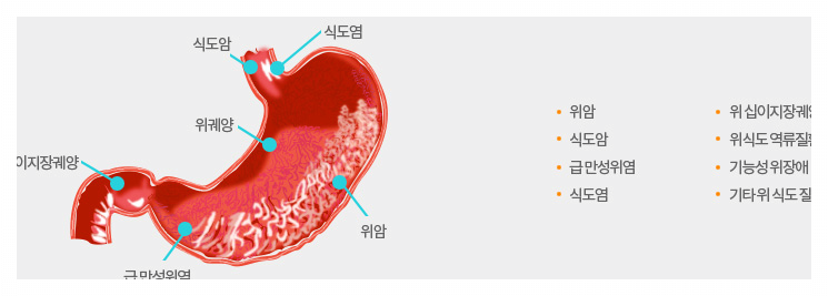 위내시경-금식시간