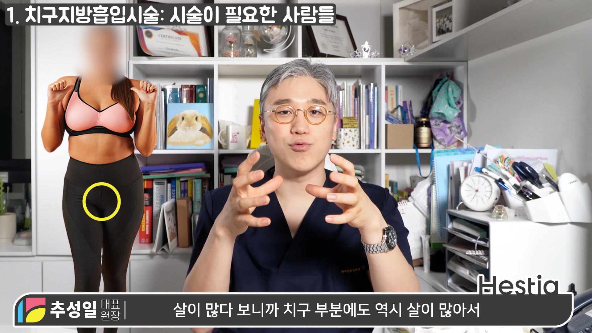 y존돌출 치구지방흡입시술