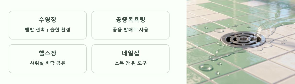 발톱 무좀 원인