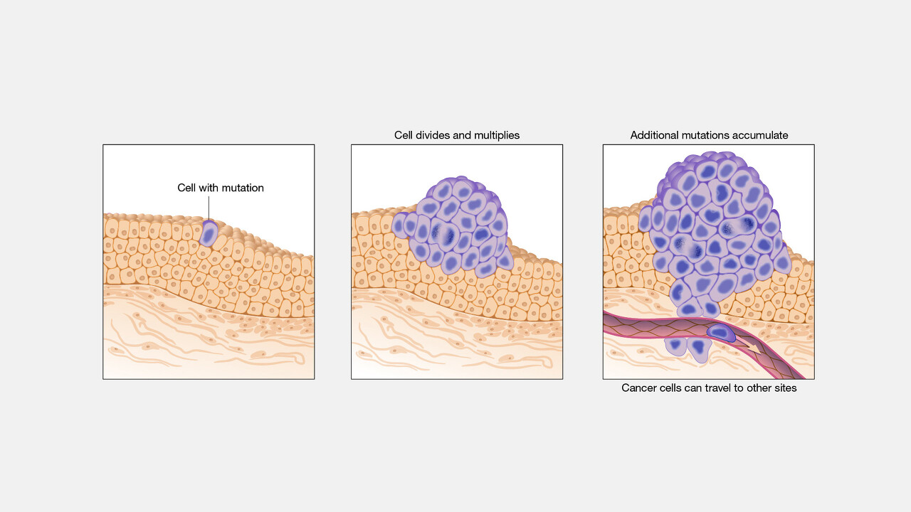 무한복제하는 암세포