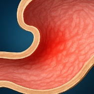 소화잘되는 음식