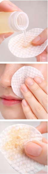 토너패드로 노폐물 관리