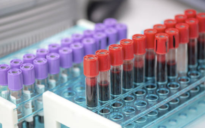 같은 샘플인데 다른 metabolite profile이 나오는 이유