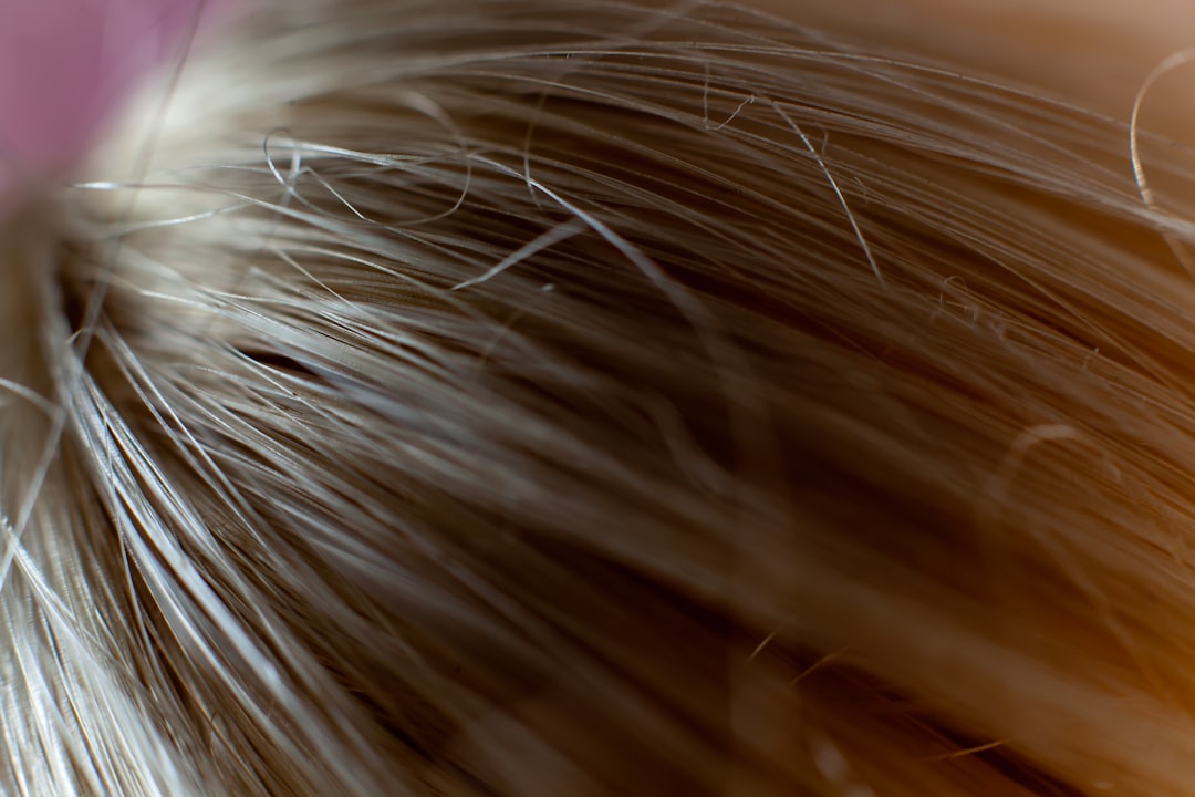 Hair loss.