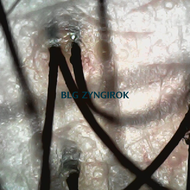 탈모 극복 프로젝트 - 뒷머리 두피모습이다.