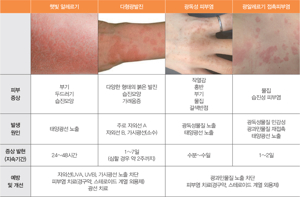 알레르기 피부염