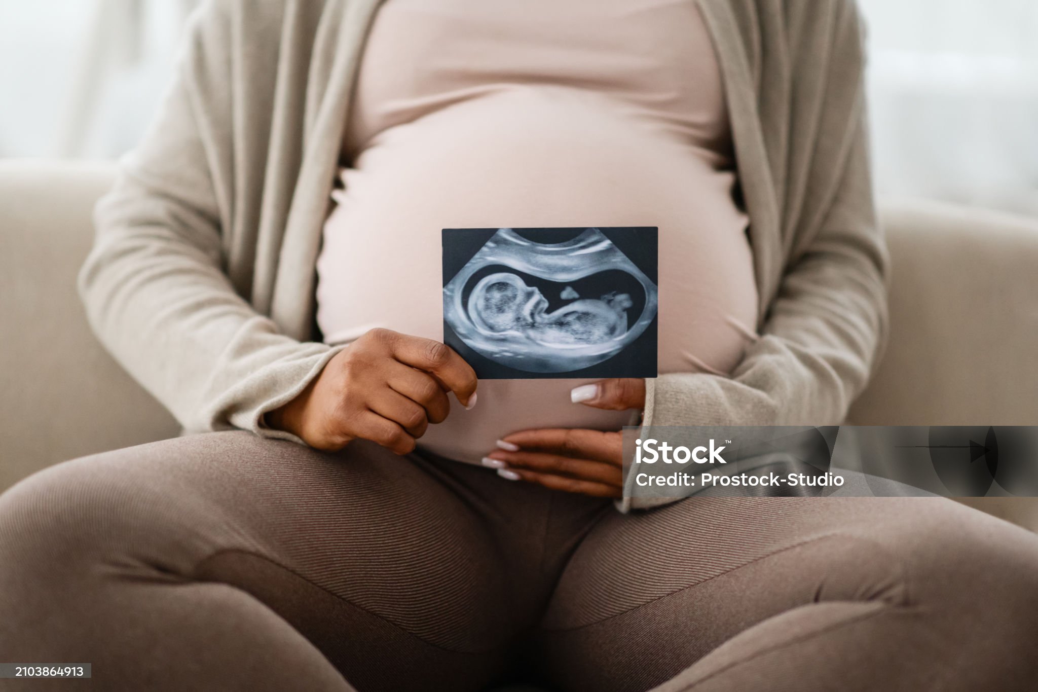 임신 중 홍역 감염의 위험성과 태아 건강