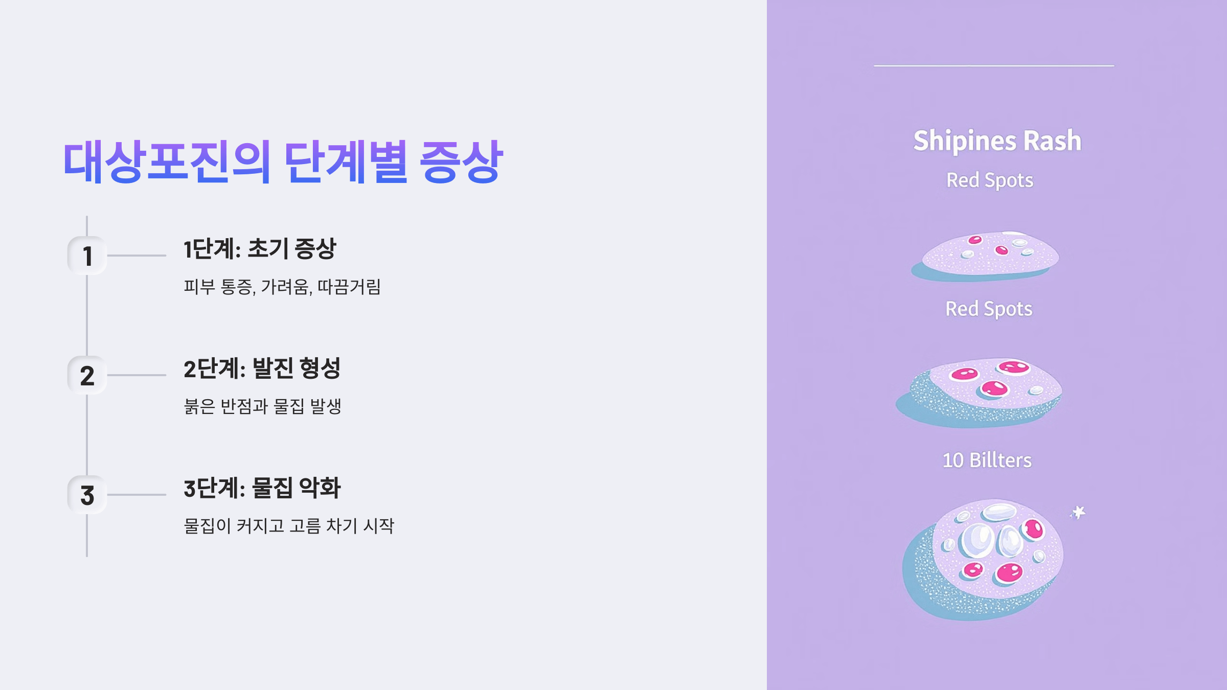 대상포진과 관련된 사진입니다.