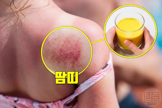 땀띠에 좋은 음식 강황차