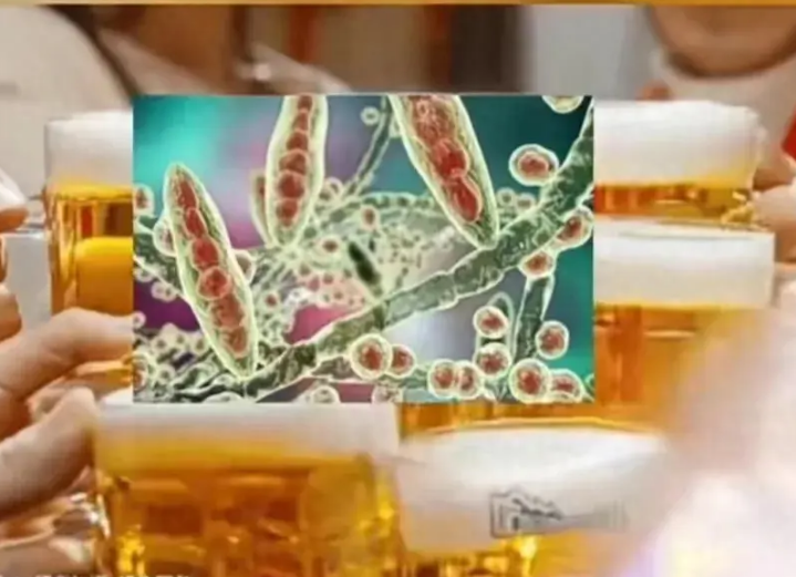 하얼빈 맥주 보미톡신