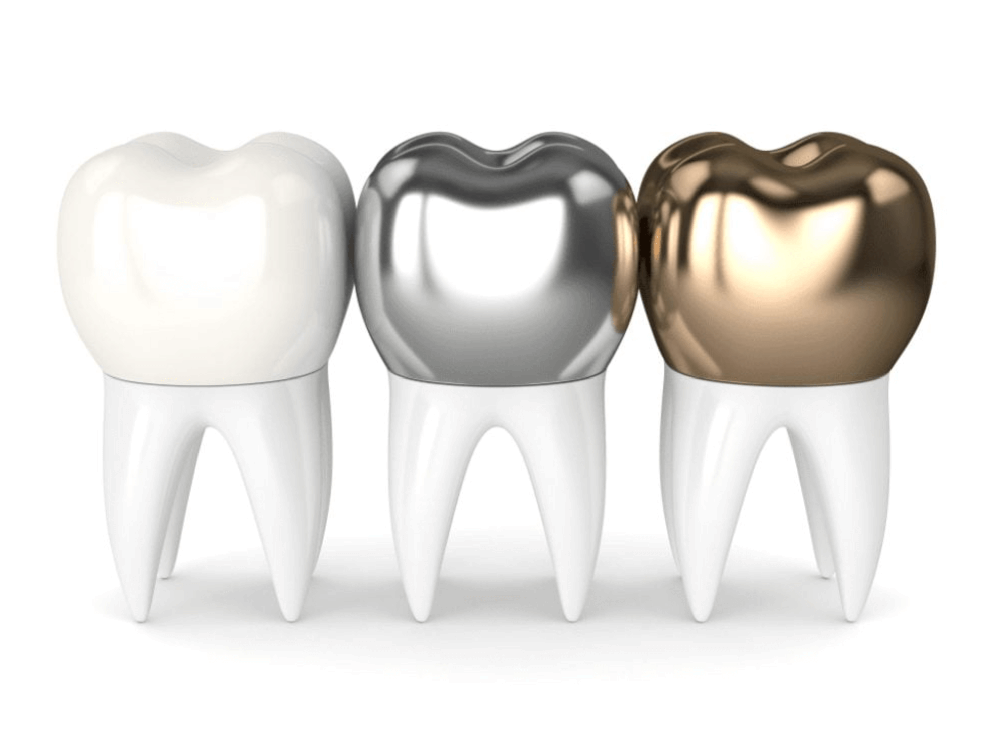 어금니 지르코니아 가격