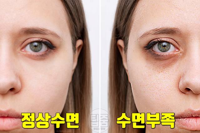 수면부족 증상 피부 콜라겐 잠잘오는법