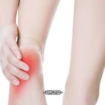 통풍 원인