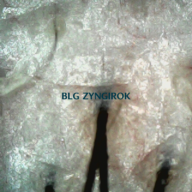 피나모아 복용 15주차 두피 사진 - 뒷머리 모습이다.