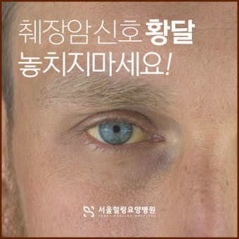 췌장암 초기증상과 진단 지연의 원인 &ndash; 왜 침묵의 암인가