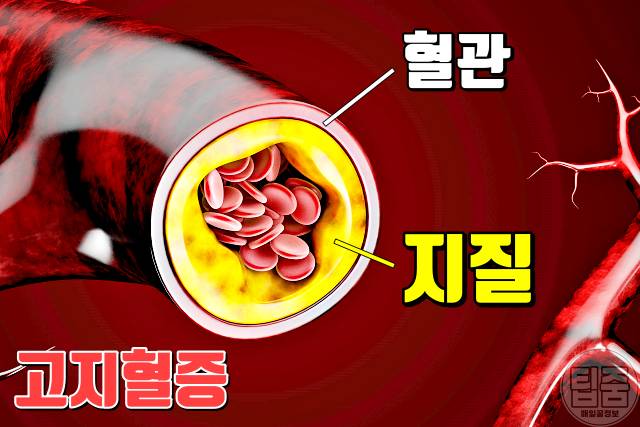 모계유전 질병 고지혈증