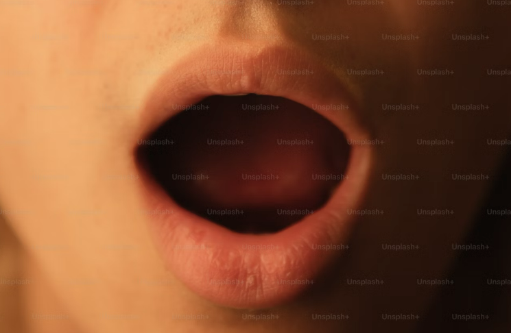 입냄새