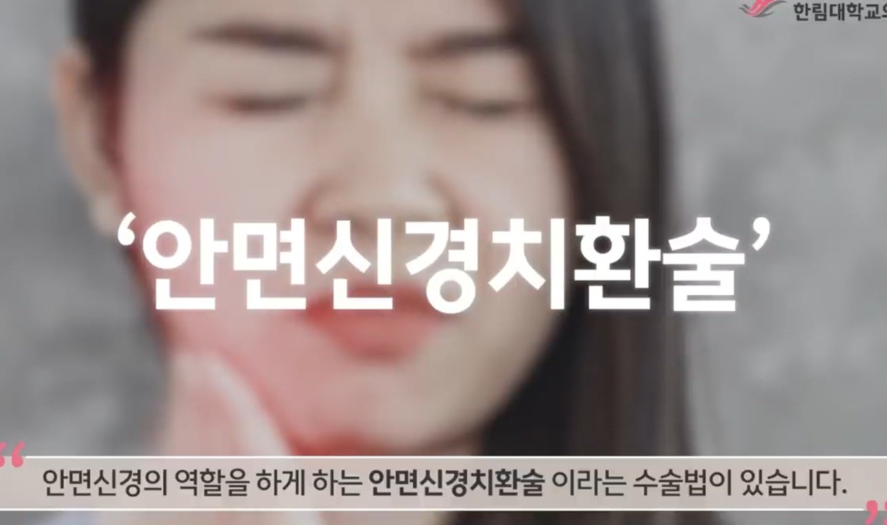 안면신경치환술